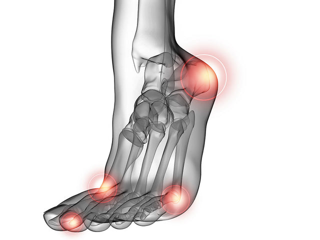 4 PRACTICAL WAYS TO COMBAT BLISTERS